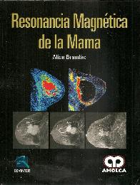 Resonancia Magntica de la Mama