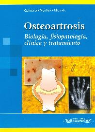 Osteoartrosis