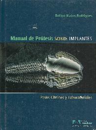 Manual de Protesis sobre Implantes