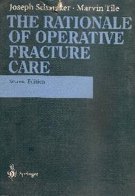 The rationale of operative fracture