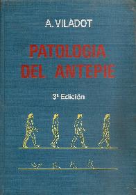 Patologia del antepie