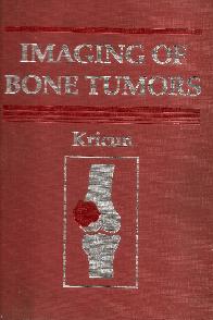 Imaging of bone tumors