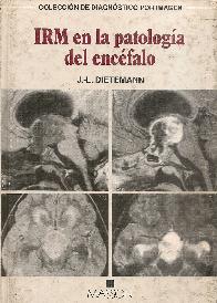 IRM en la patologia del encefalo