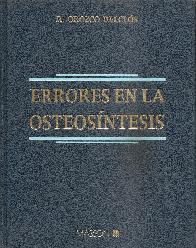 Errores en la osteosintesis