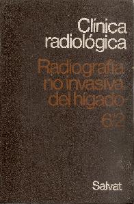 Radiografia no invasiva del Higado