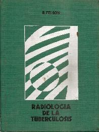 Radiologia de la tuberculosis