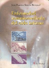 Enfermedad inmuno mediada del Oido Interno