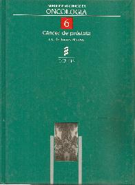 Cancer de prostata