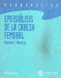 Epifisiolisis de la cabeza femoral