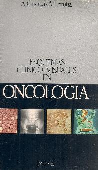 Esquemas clinico-visuales en oncologia