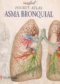 Asma Bronquial Pocket Atlas