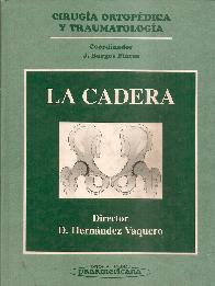 Cirugia ortopedica y traumatologia : la cadera