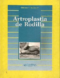 Artroplastia de la rodilla