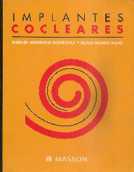 Implantes cocleares