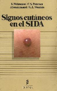 Signos cutaneos en el SIDA