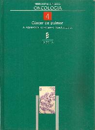 Cancer de pulmon