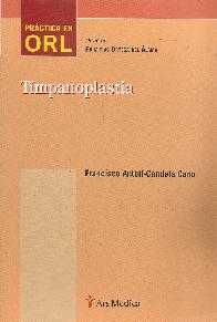 Timpanoplastia