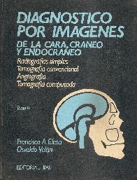 Diagnostico por imagenes de la cara, craneo y endocraneo 2