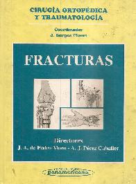 Fracturas Cirugia ortopedica y traumatologia