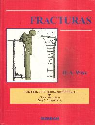Fracturas