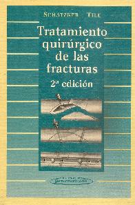 Tratamiento quirurgico de las fracturas