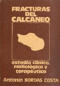 Fracturas del calcaneo