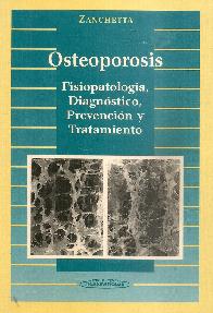 Osteoporosis