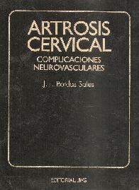 Artrosis cervical