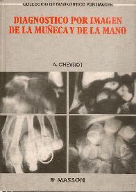 Diagnstico por Imagen Mueca y Mano