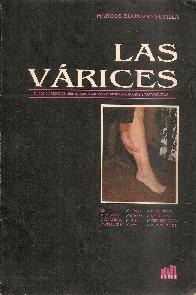 Las Varices