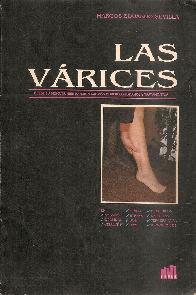 Las Varices