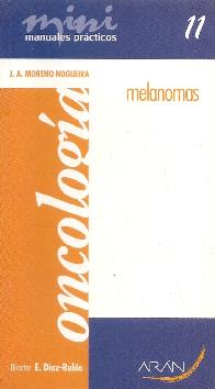 Melanomas