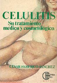 Celulitis Su tratamiento medico y cosmetologico