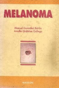 Melanoma