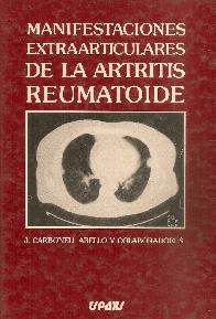Manifestaciones extraarticulares de la artritis reumatoide