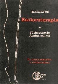 Escleroterapia y flebectoma ambulatoria Manual