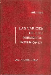 Las varices de los miembros inferiores