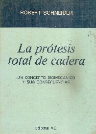 Protesis total de cadera