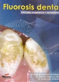 Fluorosis dental