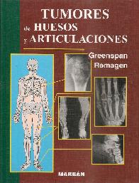 Tumores en huesos y articulaciones