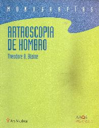 Artroscopia de Hombro