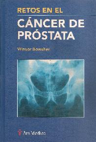 Retos en el cancer de prostata