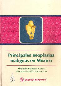 Principales Neoplasias Malignas en Mxico