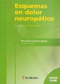 Esquemas de Dolor Neuropatico