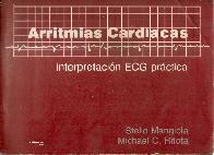 Arritmias Cardiacas Interpretacion ECG practica