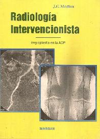 Radiologa intervencionista: angioplastia en la arterioesclerosis obliterante perifrica
