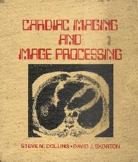 Cardiac imaging and image processing