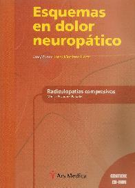 Esquemas de Dolor Neuroptico