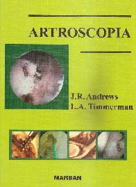 Artroscopia