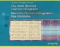 Nuestros (ECG) electrocardiogramas mas queridos